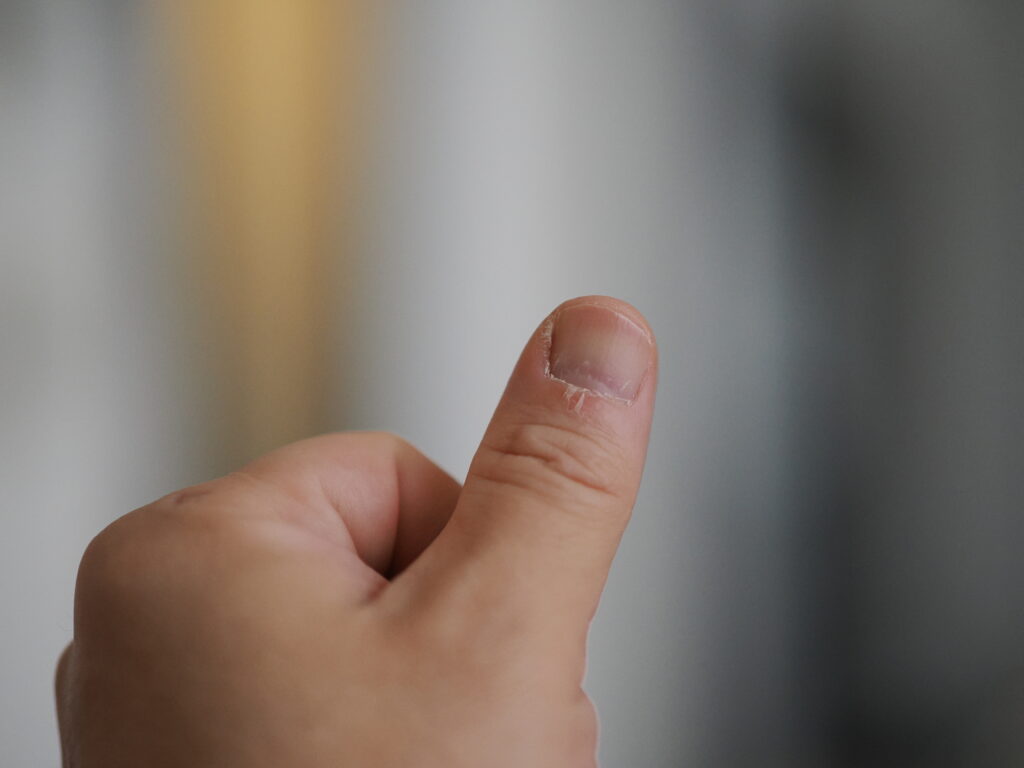 絞り開放で左手拇指を昼間に撮影。